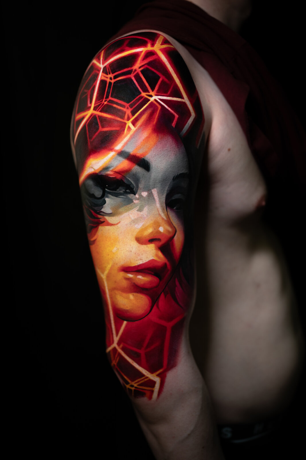 Healed forearm — 1 year